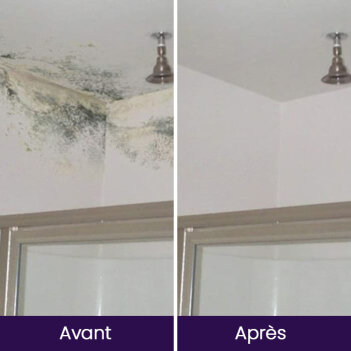 NuroClean image