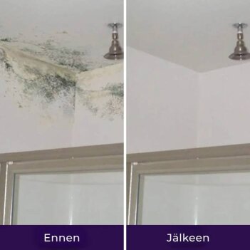 NuroClean image