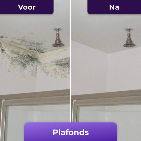 NuroClean image