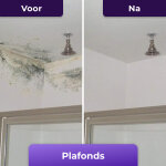 NuroClean image